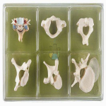 Collection Box "Vertebrae & Spinal Cord" Model